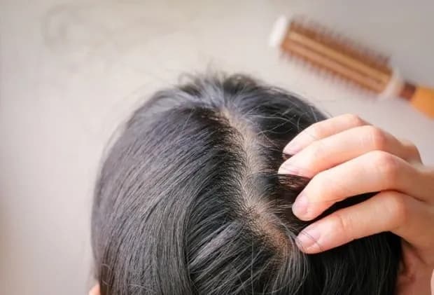 "탈모 고민에 약 먹다가…" 치과의사 면허 정지된 사연